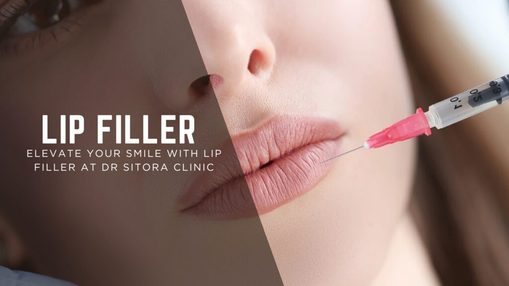 Lip Fillers in Dubai